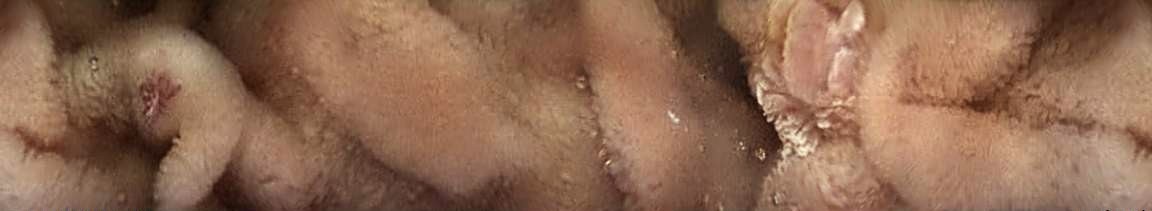 A panoramic small-bowel image captured by CapsoCam Plus, showing the papilla and a vascular lesion