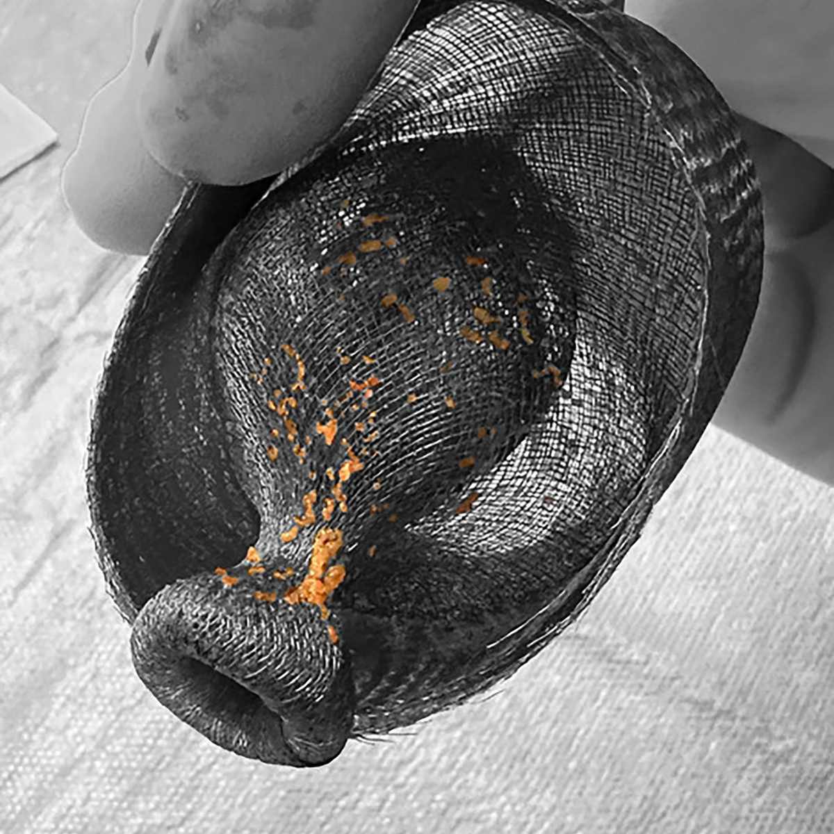 Close-up of a retrieved Emboliner mesh filter held between gloved fingers, with captured embolic debris visible as orange particles in the mesh