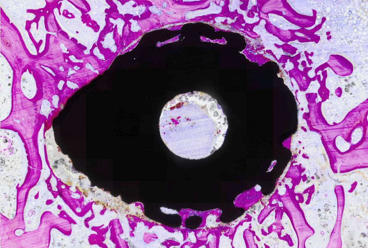 Histology section from a three-week sheep study showing bone, stained magenta, grown around and into the porous surface of an iFuse Granite Onyx implant
