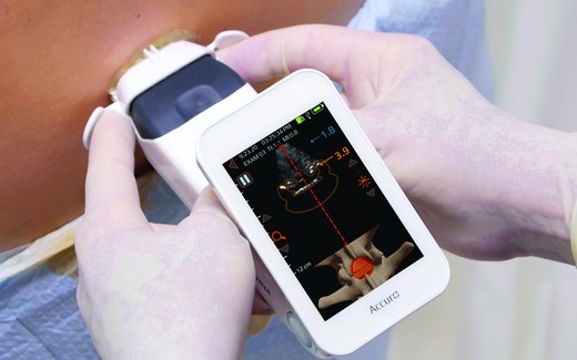 A clinician operates a handheld diagnostic imaging instrument during a patient exam, a generic stand-in, not RIVANNA's own device