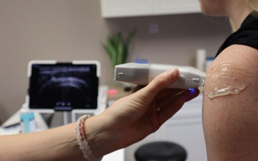 A clinician uses a handheld ultrasound probe to examine a patient's shoulder joint in a clinic, a generic stand-in for rheumatologic assessment